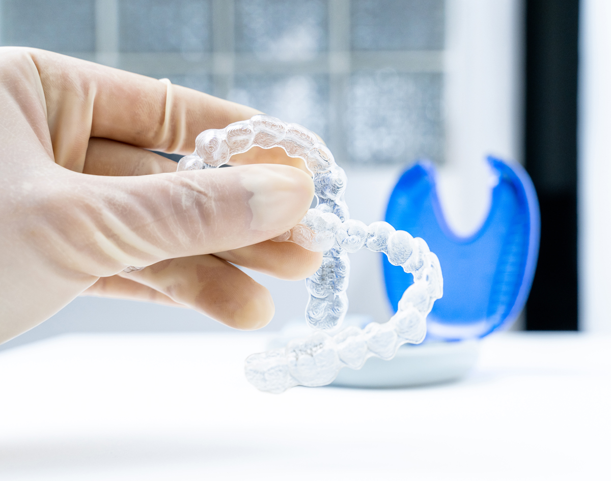 Aligner Braces
